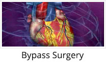 Heart Hospital Heart Care Hospital Bypass Surgery Baroda Heart Hospital India